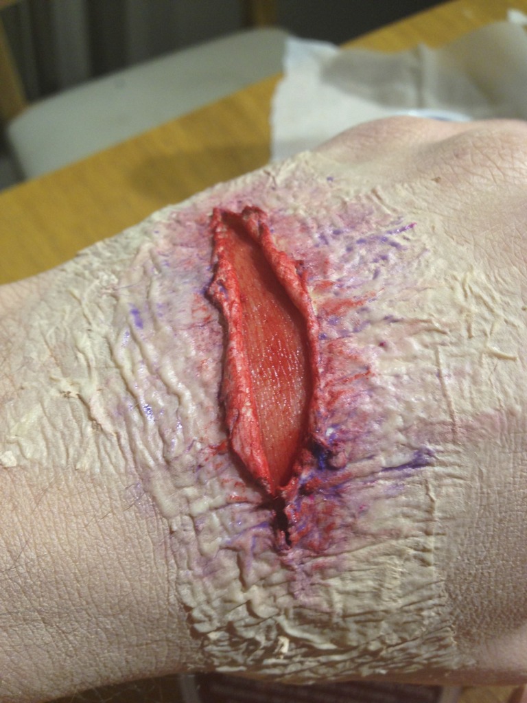Zombie Hand - Stage 4