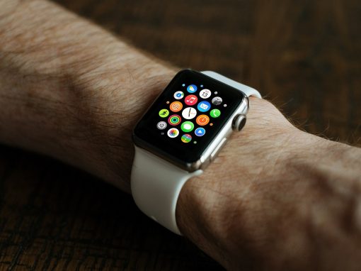 The AppleWatch – Do you need one?